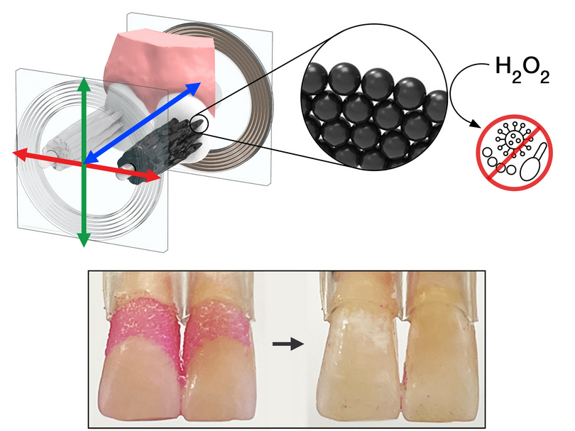 口内で歯ブラシに変形する自己組織化群体マイクロロボ、米大学が発表。歯間掃除や殺菌も