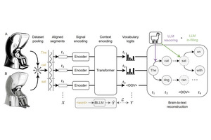「脳への電極埋め込み」なしで脳活動から高精度で考えを文字起こしするAI技術、オックスフォード大が発表(生成AIクローズアップ) 画像