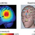 脳への電気刺激が高齢者の記憶力を向上させる実験結果。短時間の刺激で1か月持続