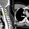 BMJ Case Reports