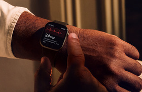 Apple Watch用の血糖値監視機能プロジェクトに「成果を生む人物」が責任者として加わる 画像